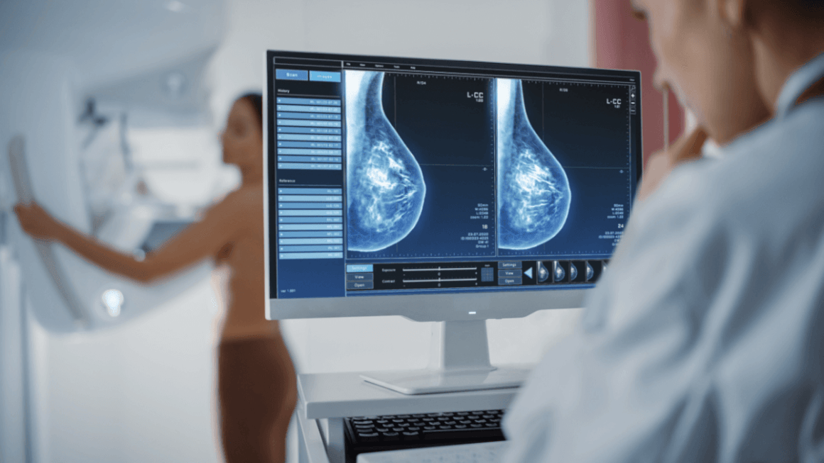 Detectarea precoce a cancerului mamar - mit sau realitate?