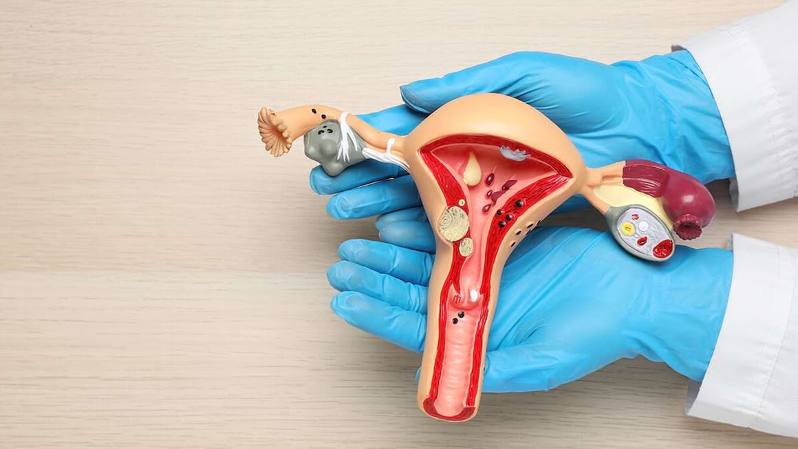 Histerosalpingografia: procedura care analizeaza uterul si trompele uterine