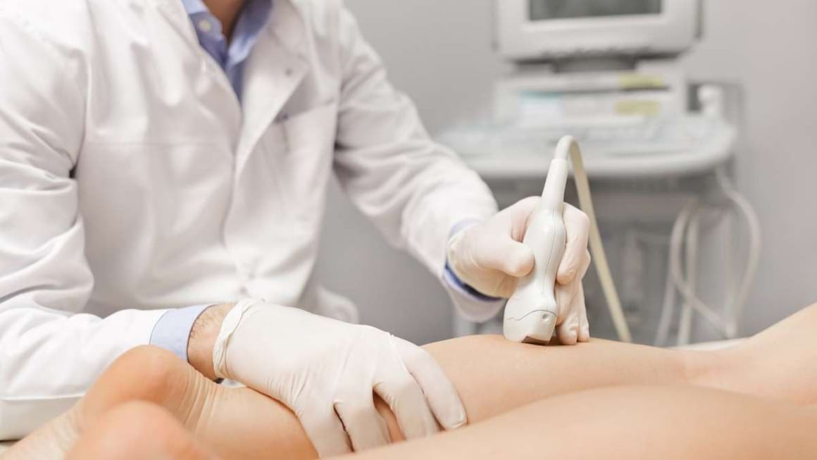 Terapia ablativa a varicelor membrelor inferioare
