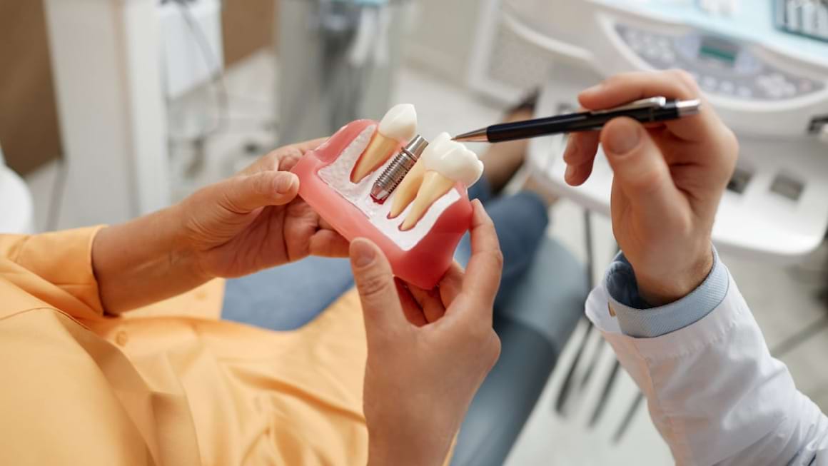 Ce avantaje are implantul dentar realizat în totalitate din ceramică