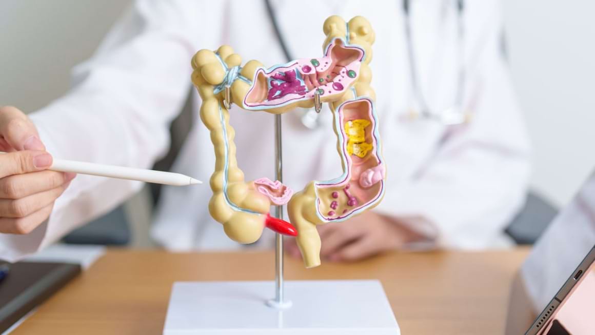 Simptomele cancerului de colon pe care si tinerii trebuie sa le stie