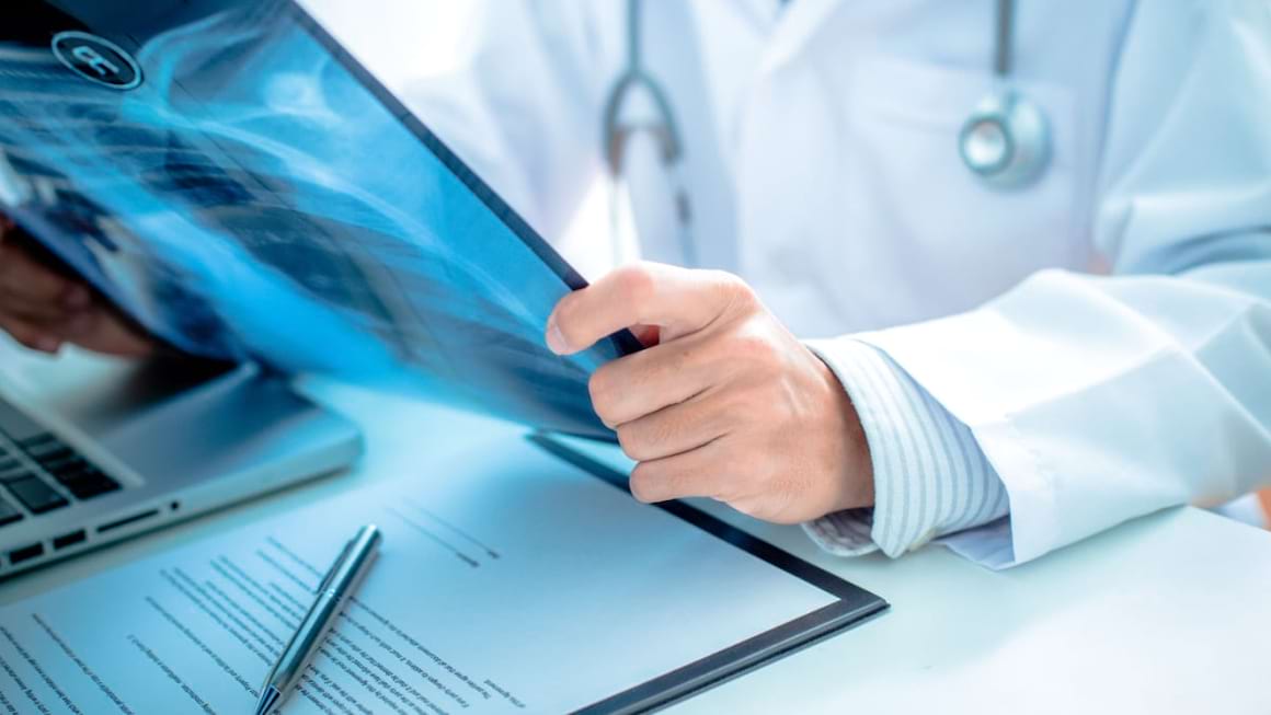 Cum poate evolua cancerul pulmonar