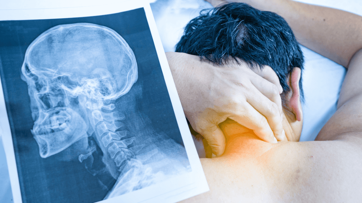 Spondiloza cervicală: cauze, simptome și cum tratăm durerea