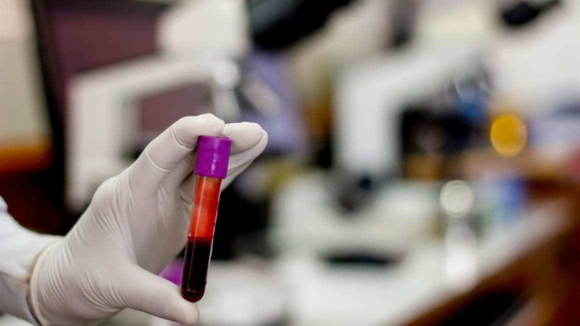 Hemograma completa: ce inseamna rezultatele si care sunt valorile normale la adulti