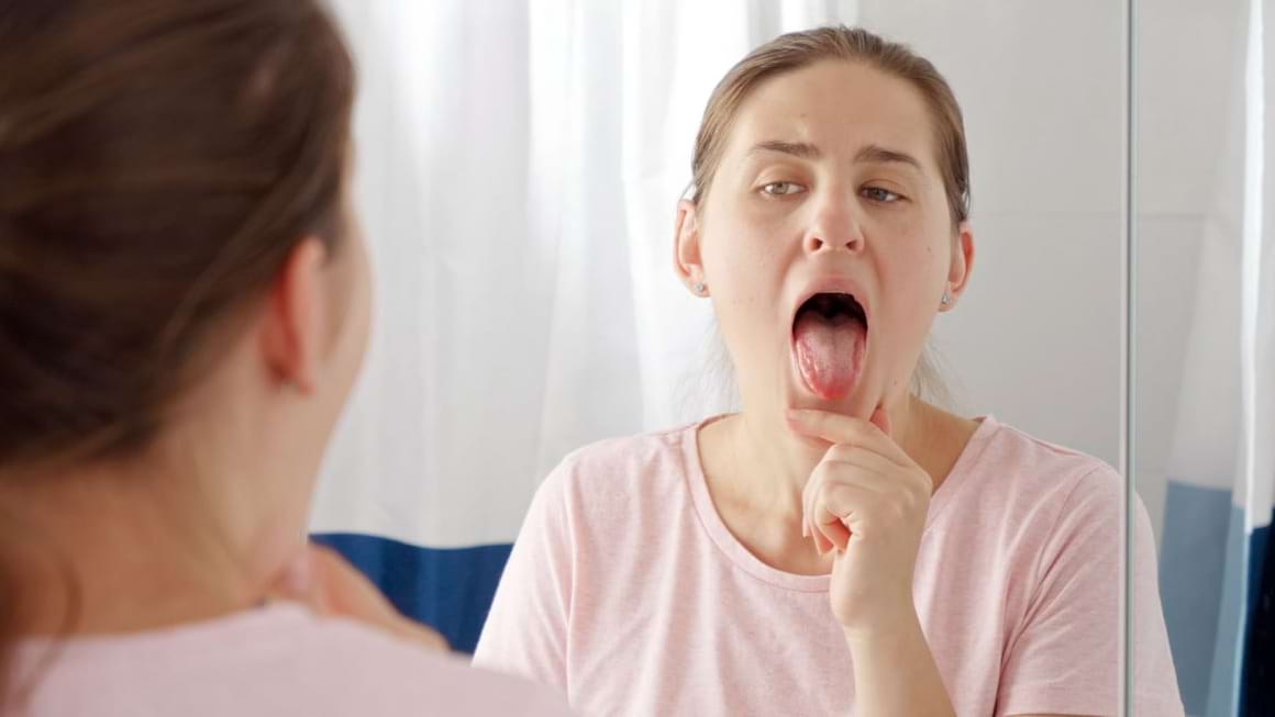 Primele simptome ale cancerului oral (cancerul limbii)