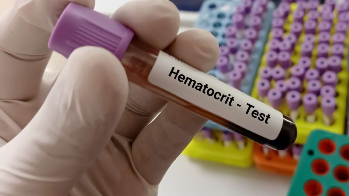 Analize de sange: totul despre hematocrit