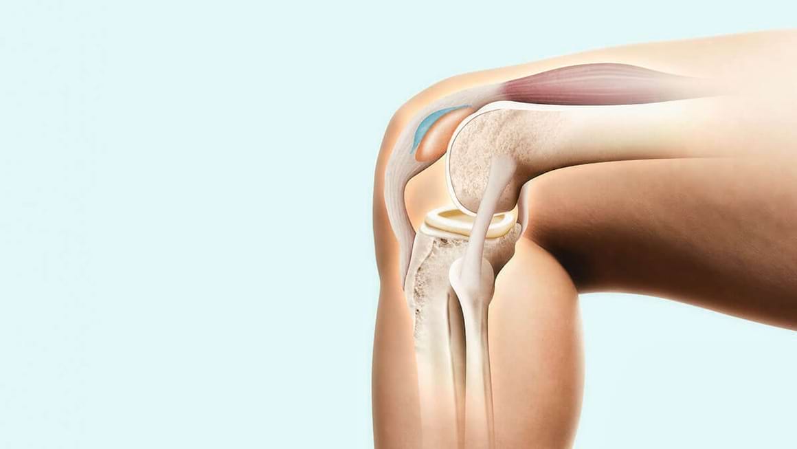 Ingustarea spatiului articular: cauze, simptome, tratament