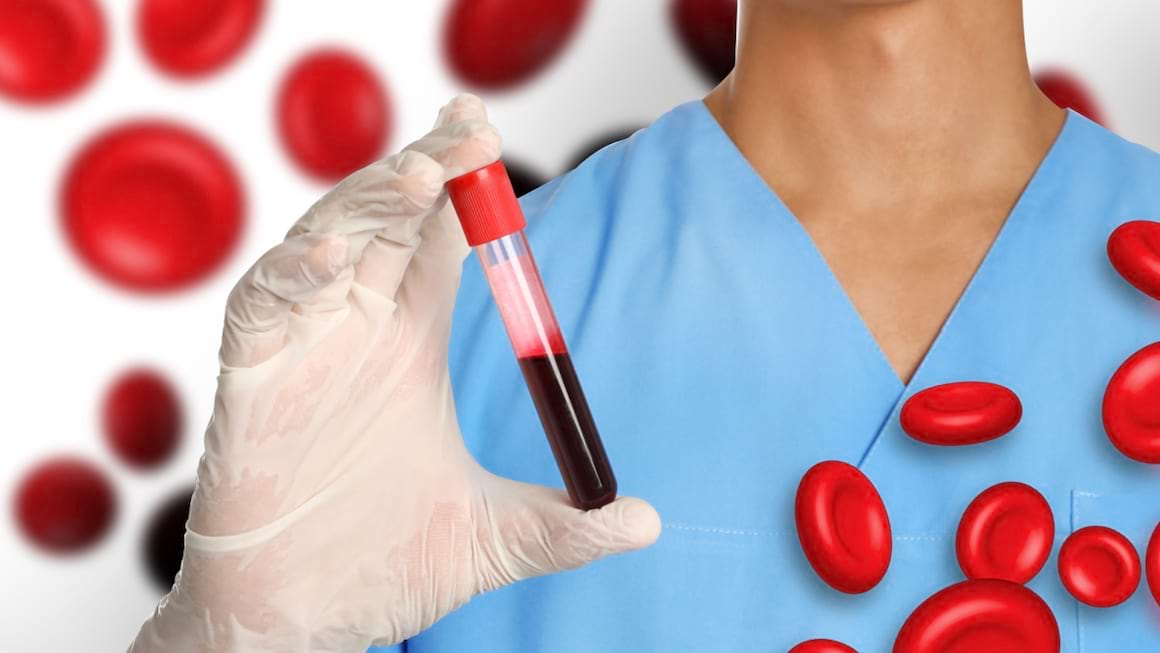 Anemia hemolitică: ce este, tratament, prevenire