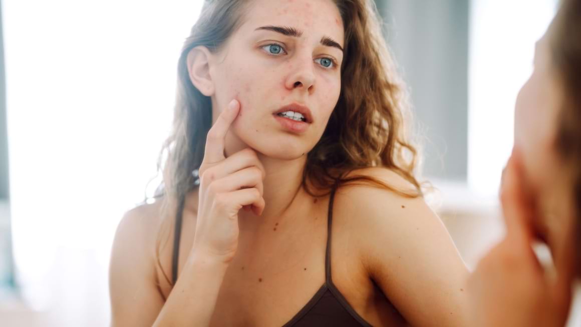 5 semne care indica neglijarea pielii pe timp de vara