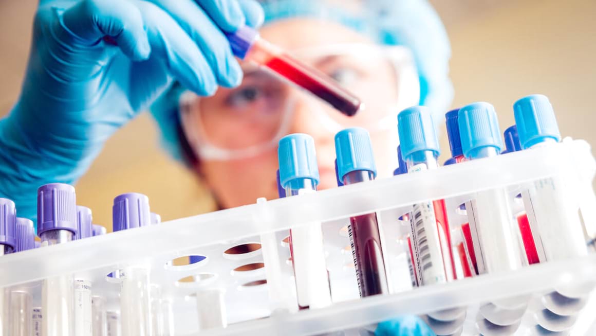 Analize pentru diagnosticarea infertilitatii la femei