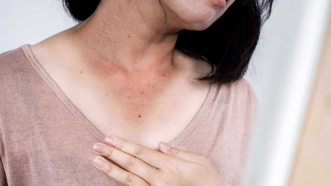 Ce efecte are diabetul asupra pielii