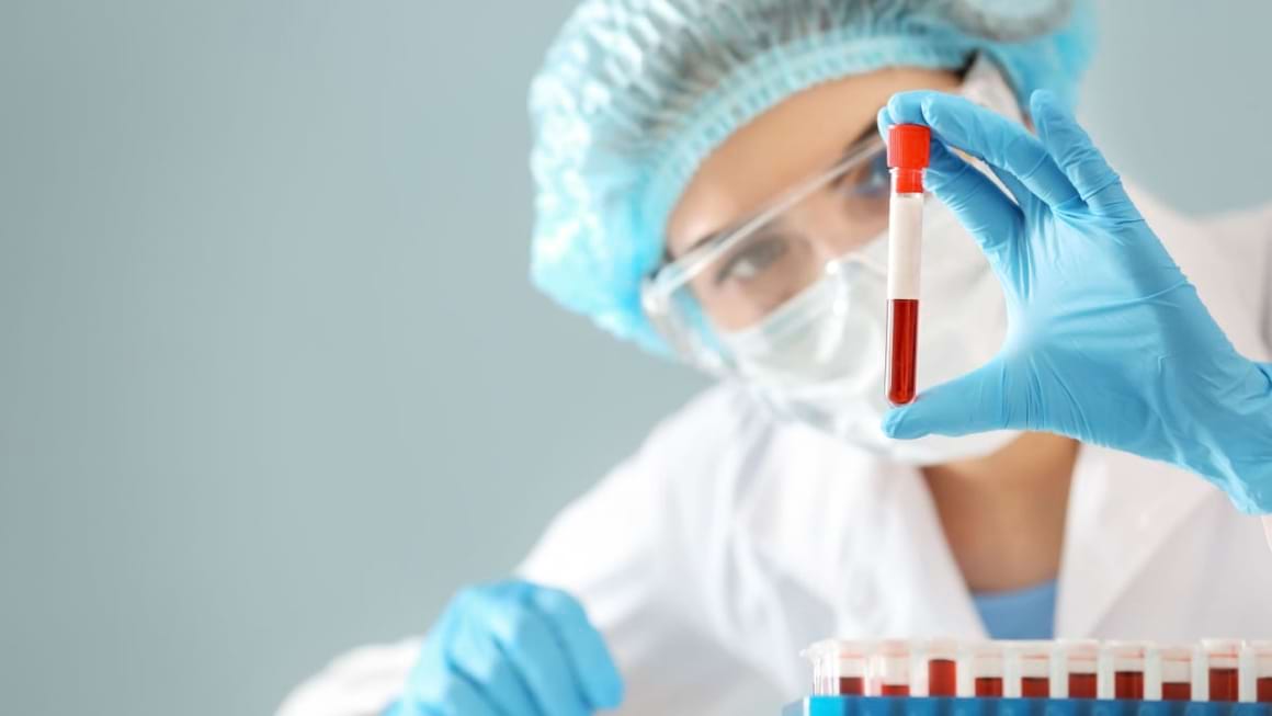 Analize care vizează nivelul de vitamine și minerale din organism