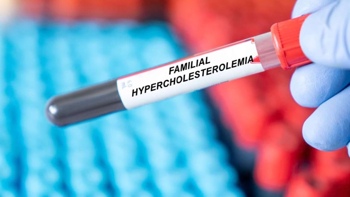 Hipercolesterolemia familiala: cauze, simptome, tratament, diagnostic
