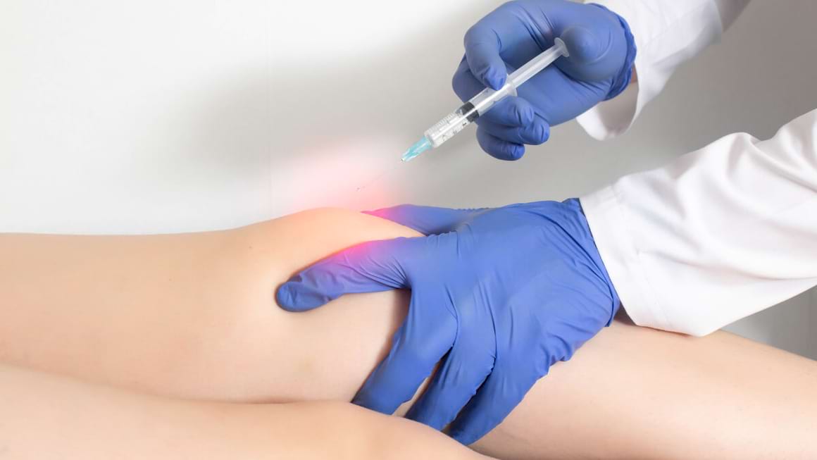 Cum influenteaza tratamentul cu sulfat de condroitină cartilajul articular?