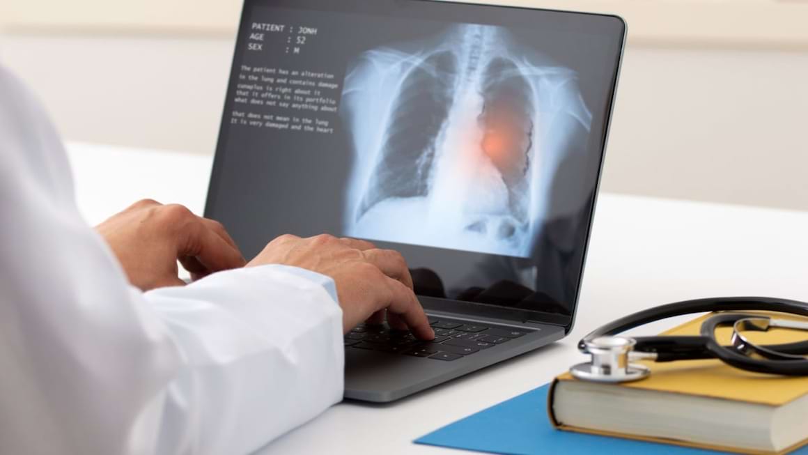 Tipuri de cancer pulmonar