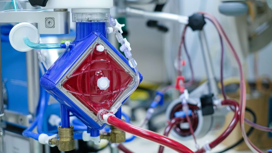 ECMO, procedura care poate salva viețile pacienților cu insuficiență respiratorie sau cardiacă
