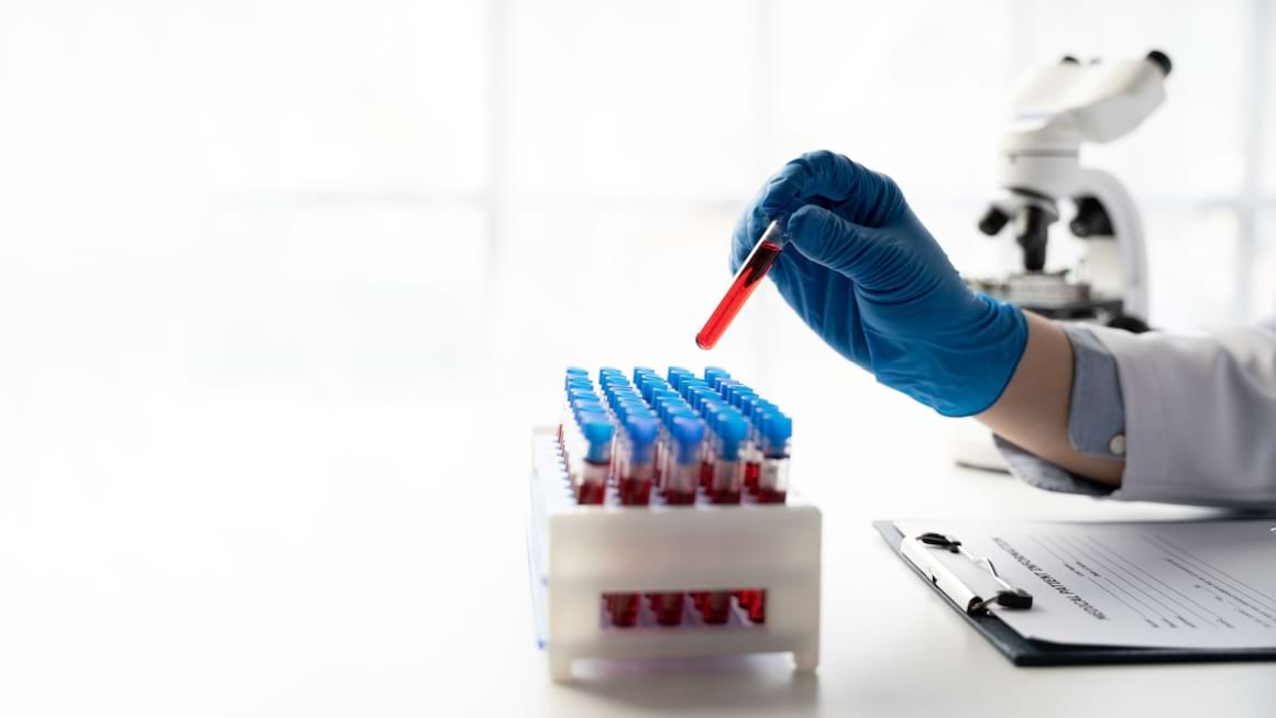 Hepatita B si meseriile care cresc riscul de infectare