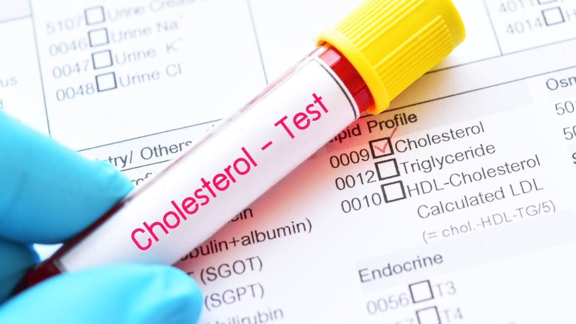 Dislipidemia la copii: simptome, diagnostic, tratament