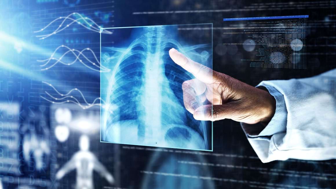 Ce este cancerul pulmonar?