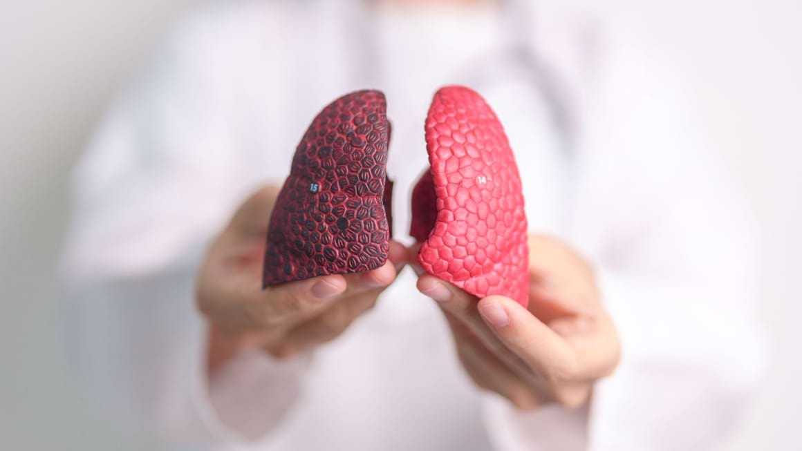 Cum arata cancerul pulmonar