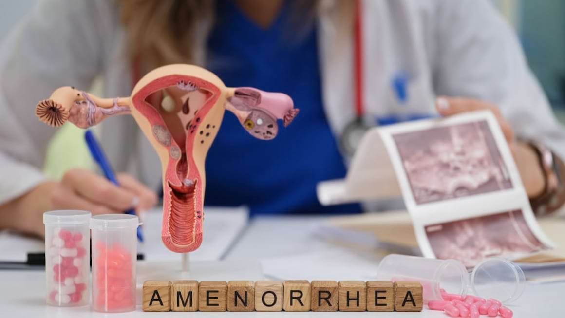 Amenoreea sau lipsa menstruatiei