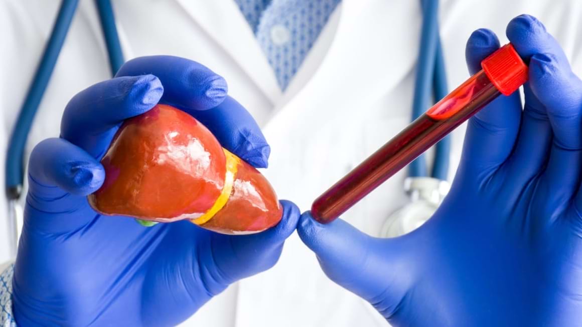Analizele specifice pacientului cu hepatită virală