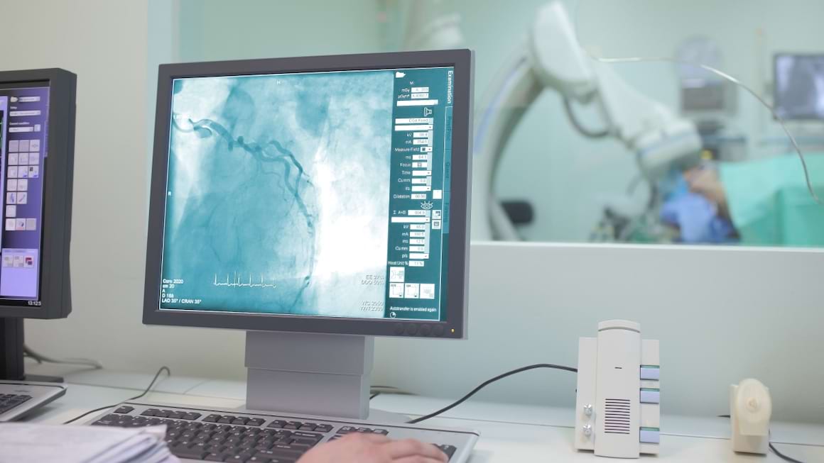 Investigaţiile cardiologice invazive: ce este coronarografia?