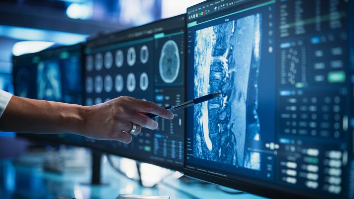 Ecografie, radiografie, CT și RMN: ce sunt și când se recomandă?