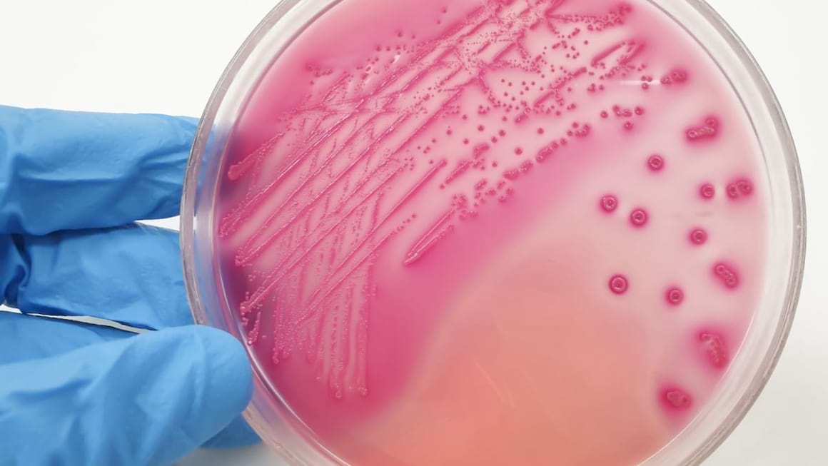 Totul despre E. coli: cum se transmite, ce afectiuni provoaca si cum poate fi prevenita