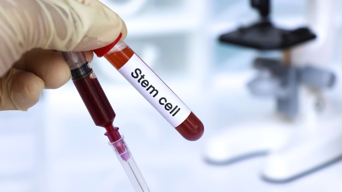 Tratamentul cu transplant de celule stem pentru limfom - beneficii și efecte secundare