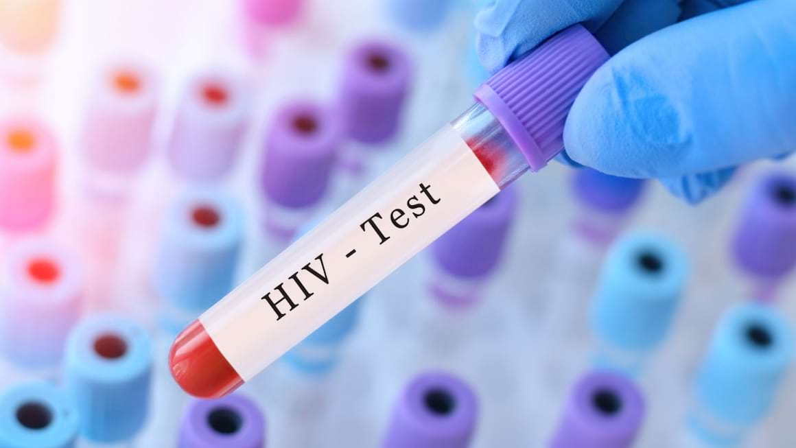 Infectia cu HIV (virusul imunodeficientei umane)
