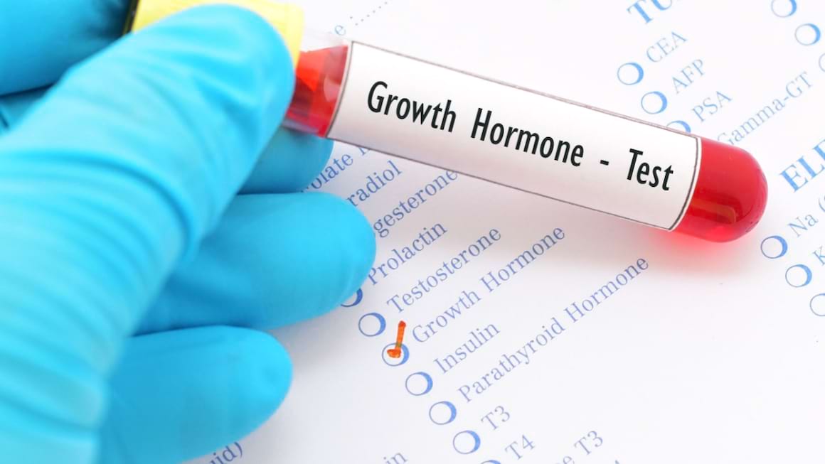 Somatotropina - ce să știi despre hormonul de creștere?