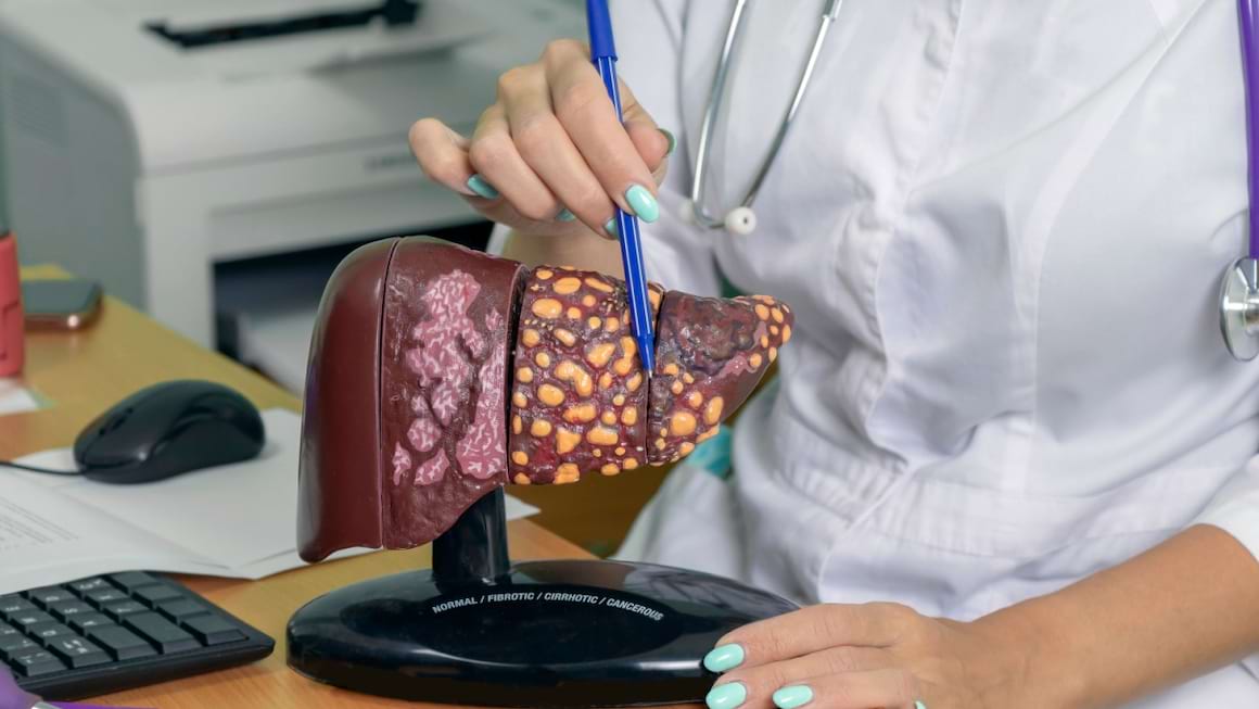 Totul despre cancerul hepatic – cauze, tipuri, simptome și prevenție