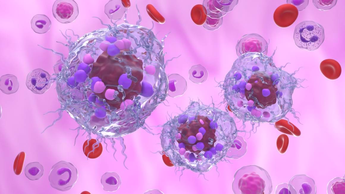 Tumorile neuroendocrine: diagnostic si tratament