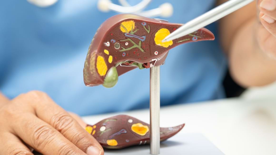 Stadiile fibrozei in hepatita C