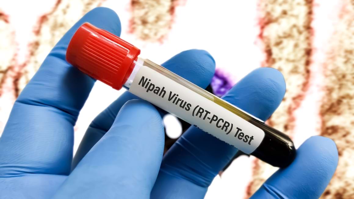 Tot ce trebuie să știi despre virusul Nipah: simptome, diagnostic, tratament