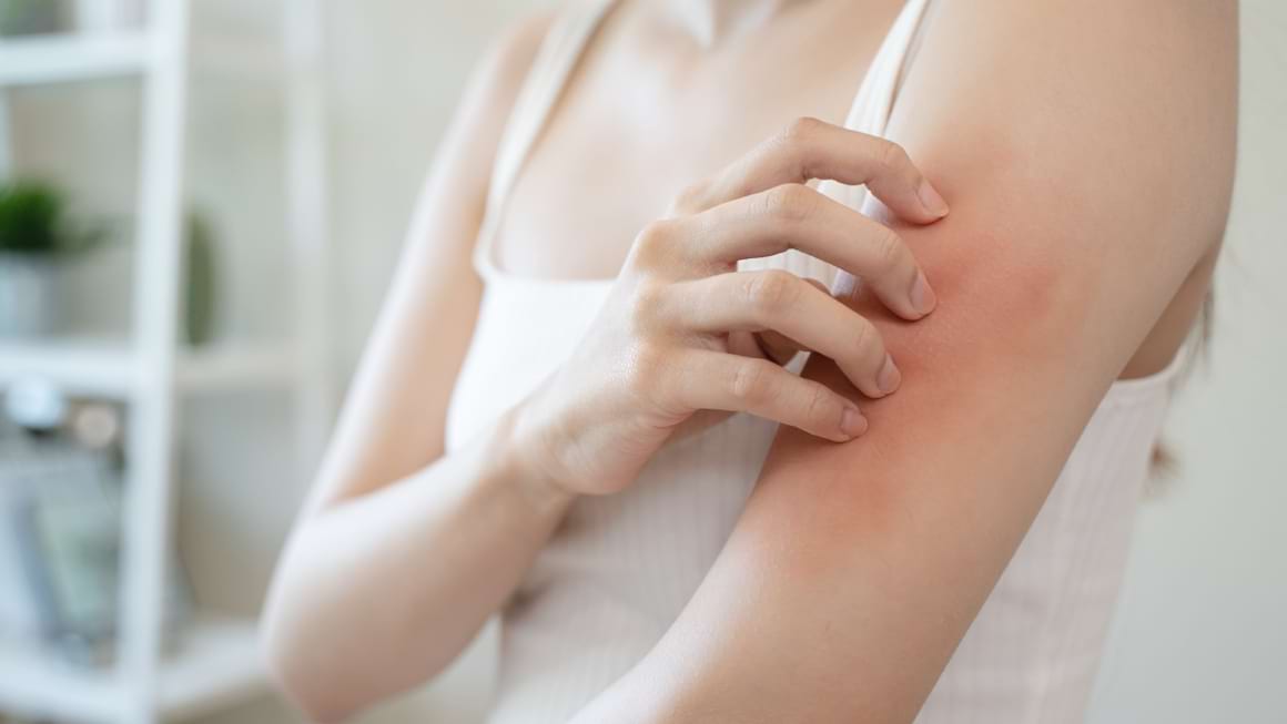 Ce este eczema: tipuri și tratament