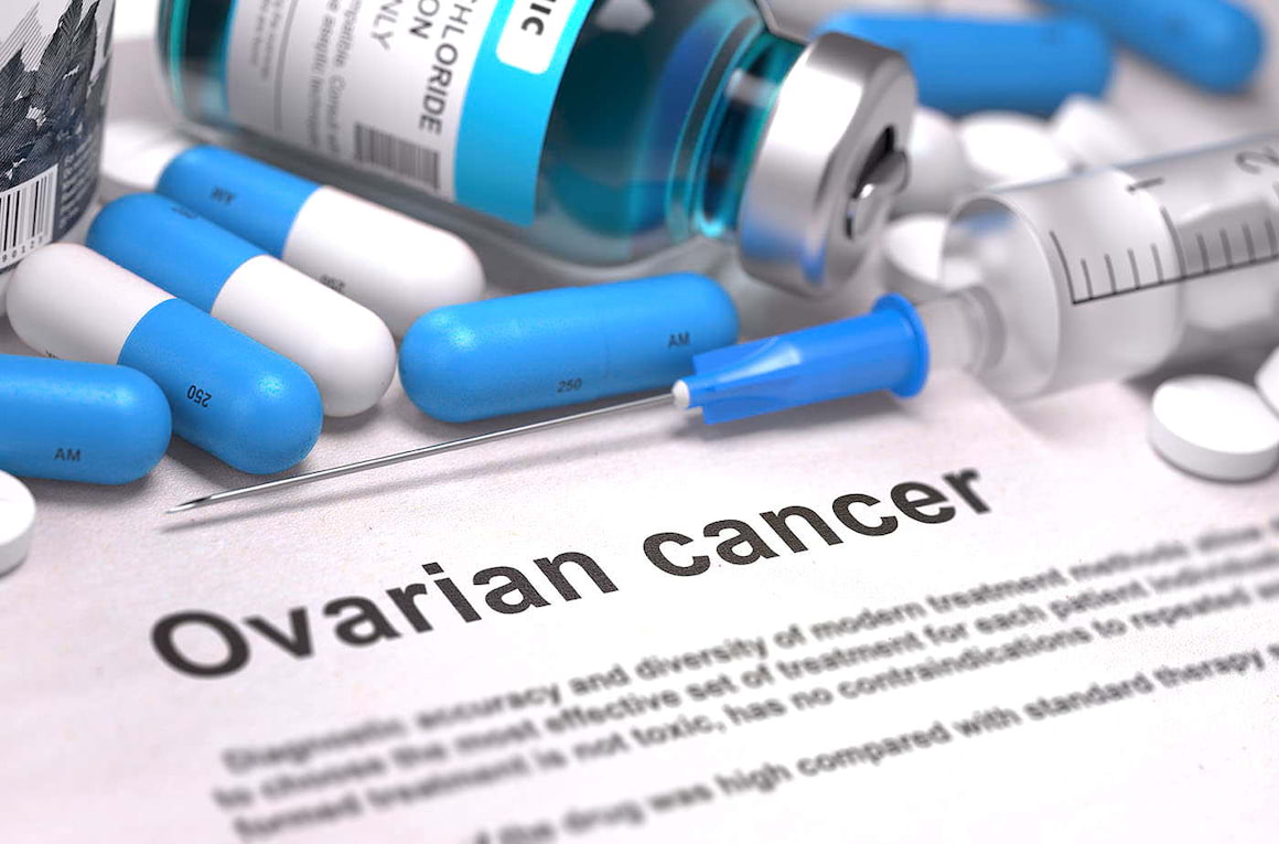 Cancerul ovarian: ar putea fi identificate beneficiarele unei terapii combinate? [studiu]