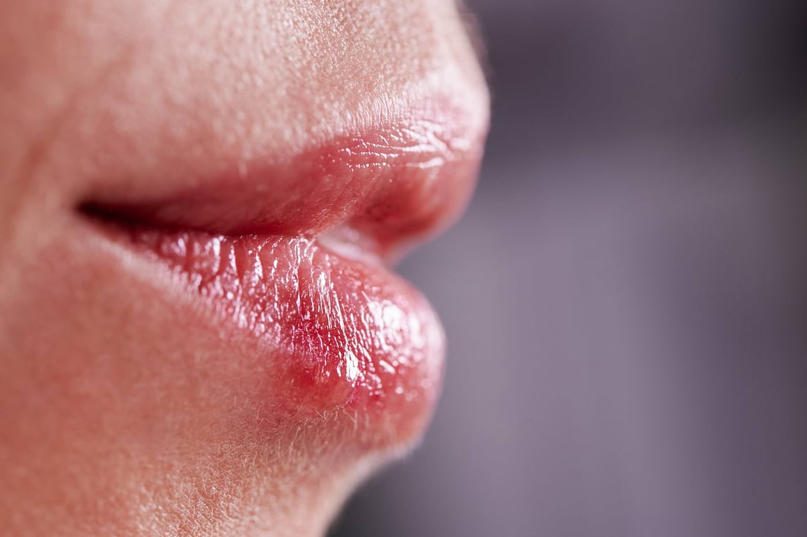 Herpesul și sexul oral: care sunt riscurile la femei? (studiu)