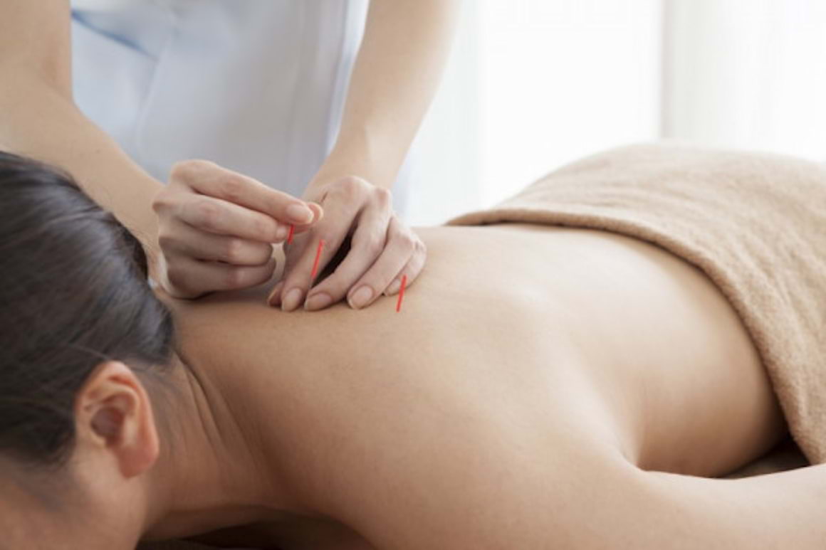Acupunctura in cazul infertilitatii: functioneaza sau nu?