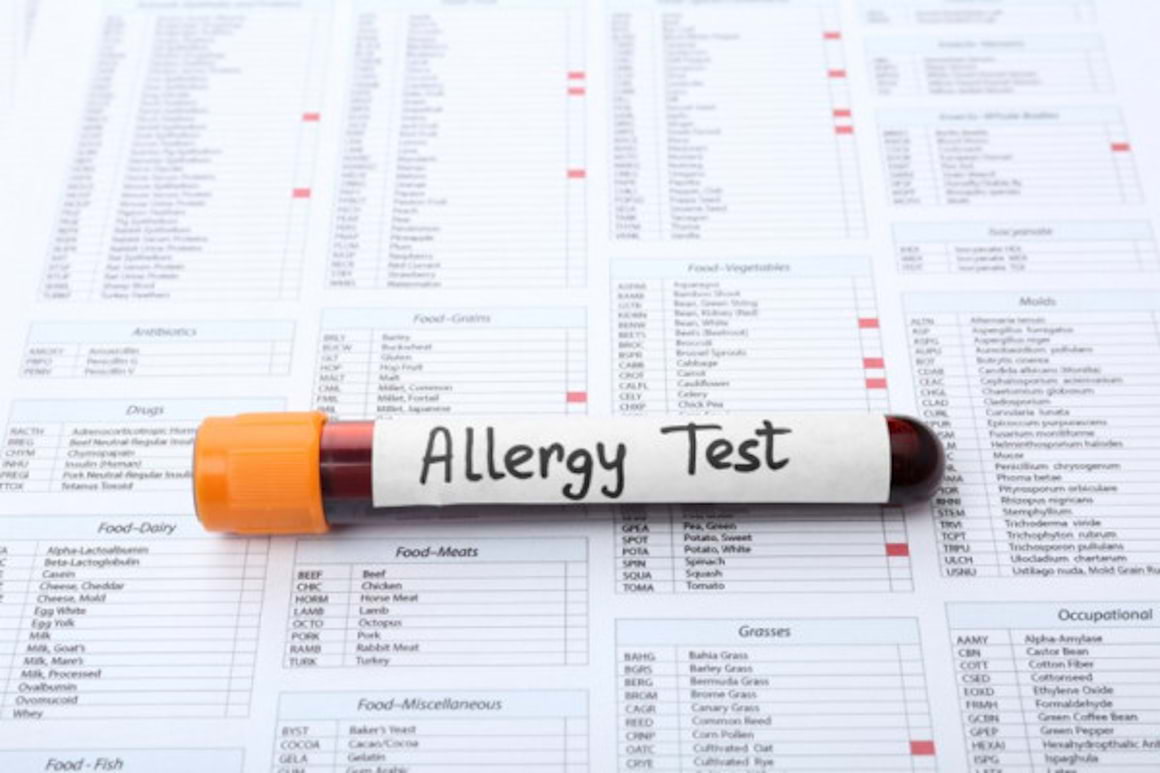 Un nou test de sange ar putea depista alergia la arahide fara riscuri [studiu]