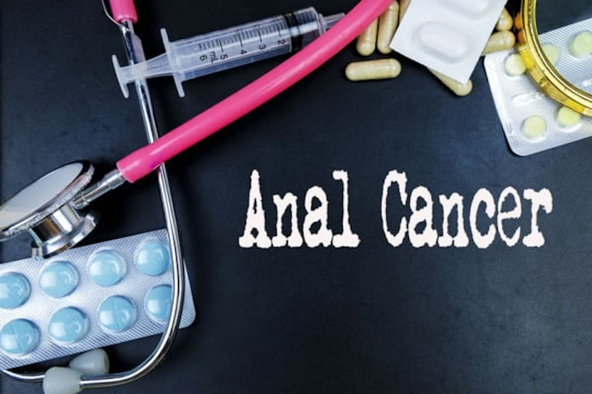 Cancerul anal: factori de risc, clasificare, simptome & tratament