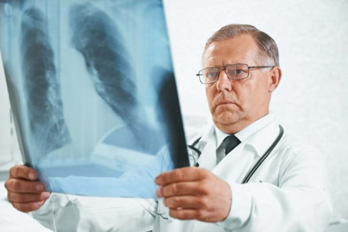Cancerul la plamani declanseaza hipertensiune pulmonara