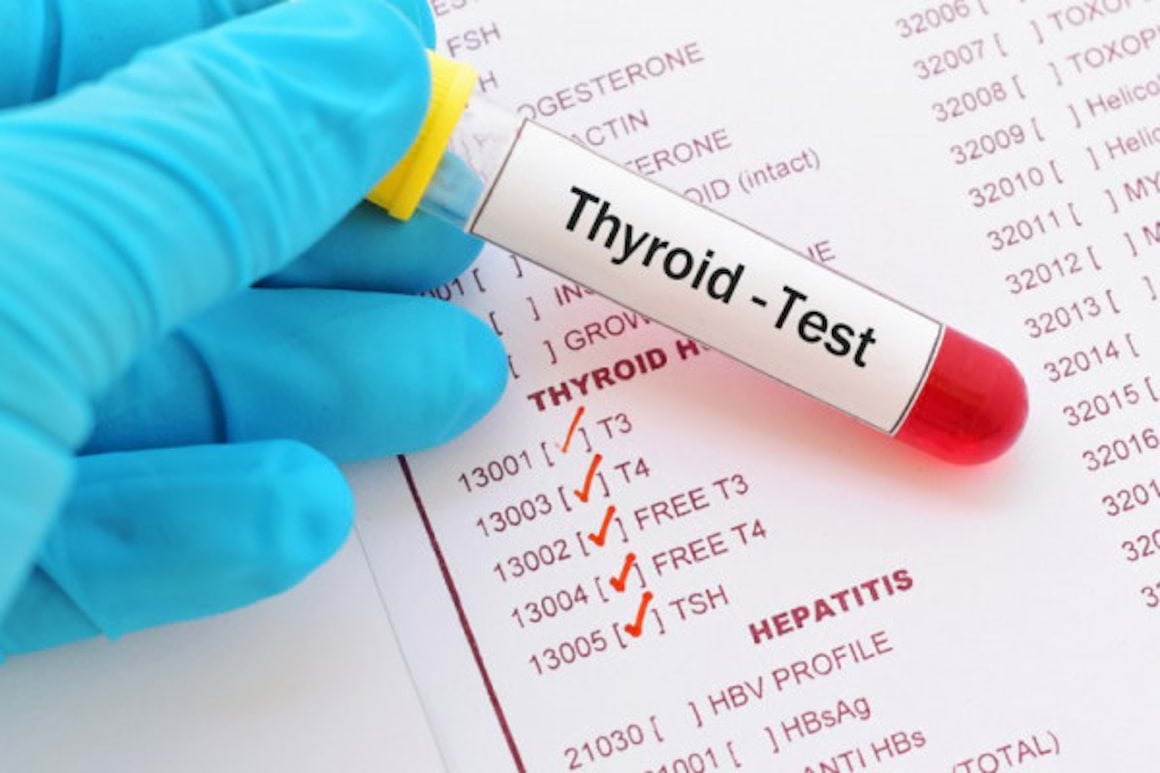 Cum se diagnosticheaza afectiunile glandei tiroide