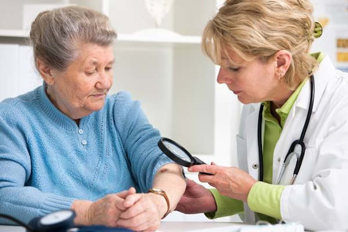 Diagnosticul melanomului - cum se stabileste