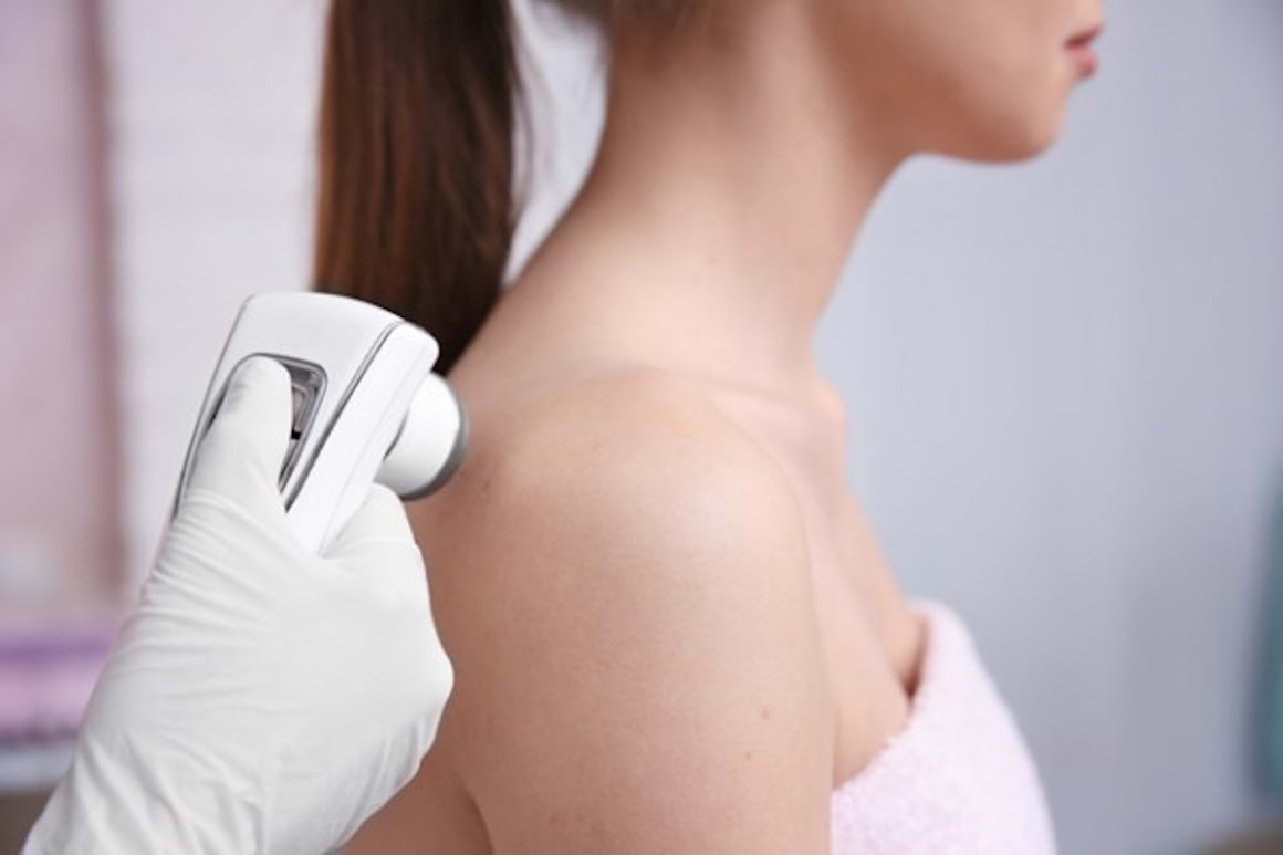 Factori care cresc riscul de cancer de piele