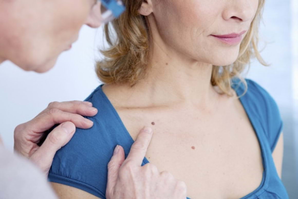 Gena ”de protectie solara” va poate proteja impotriva cancerului de piele