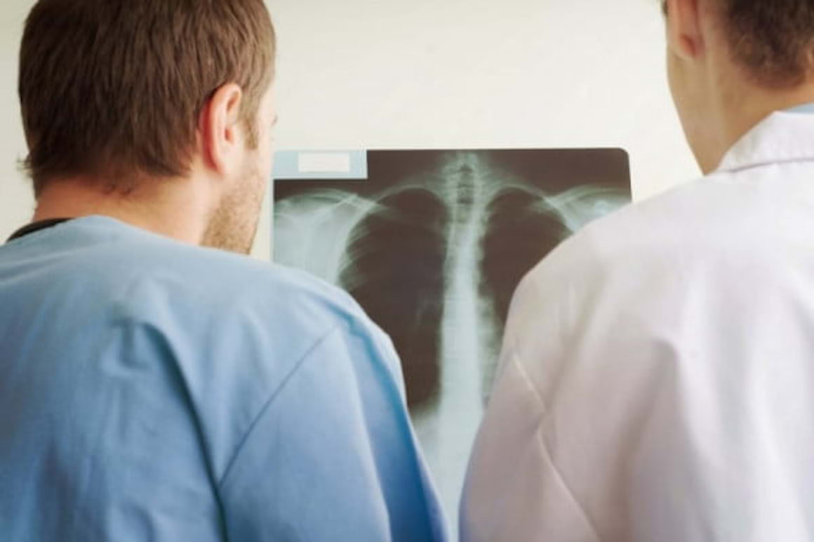Infectiile pulmonare la pacientul cu cancer