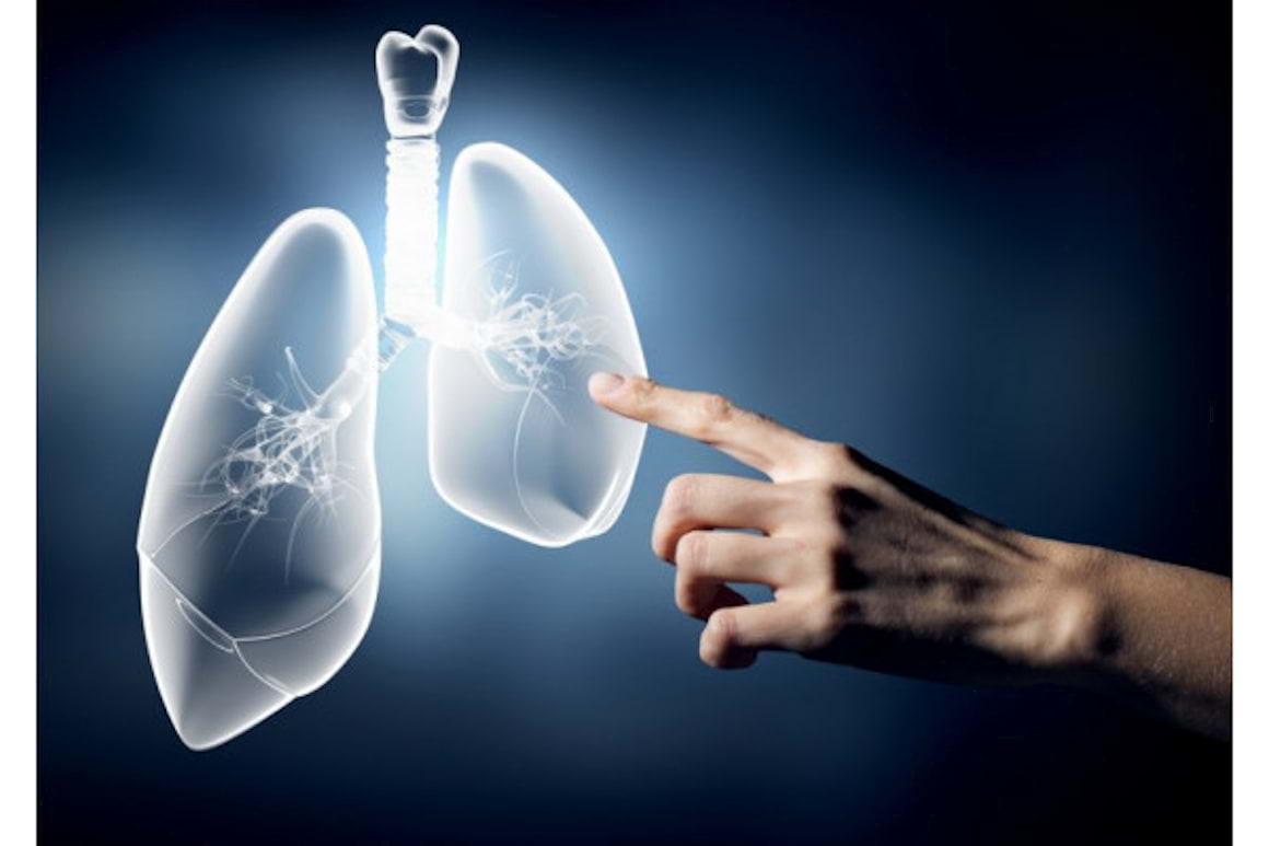 Inteligenta artificiala, folosita pentru diagnosticarea cancerului pulmonar