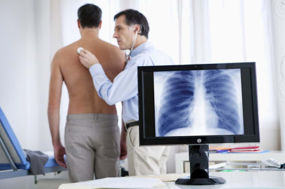 Istoricul de boli respiratorii - indicator pentru cancerul pulmonar?